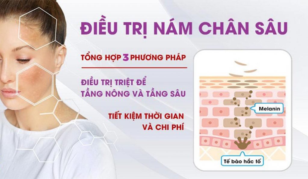 Nám mãng trị có khó không và nên dùng phương pháp nào?