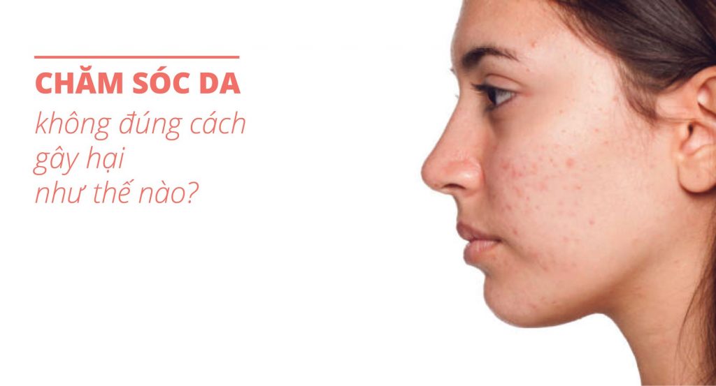 Chăm sóc da không đúng cách như thế nào